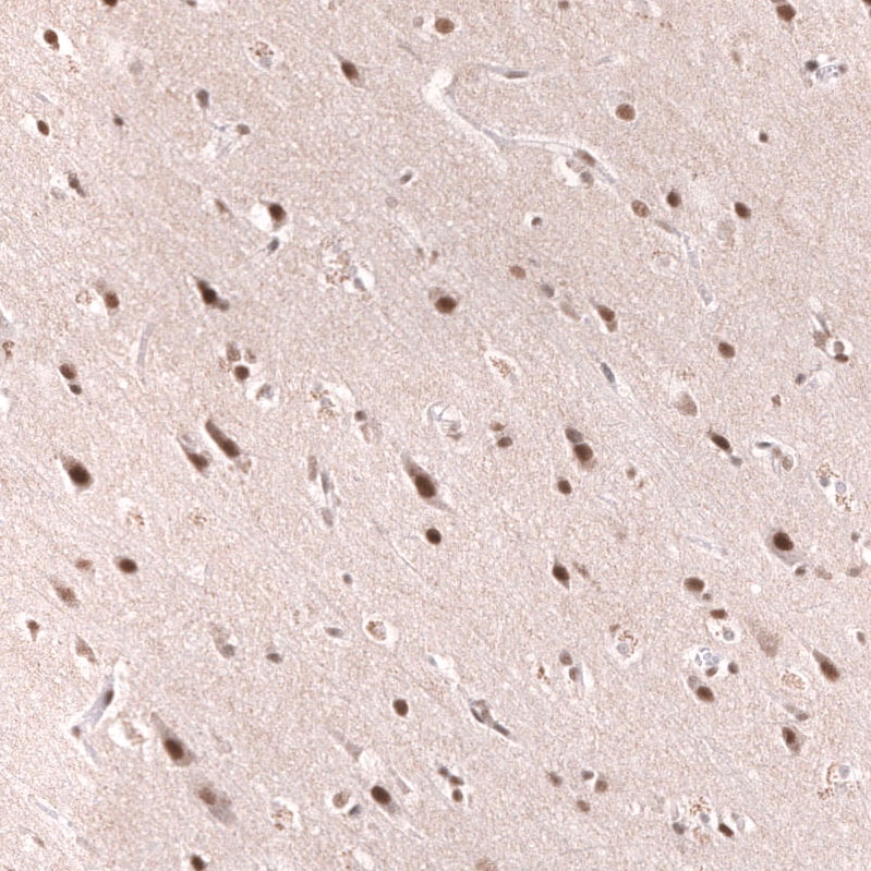 SNF5 Antibody (CL13992) - Azide and BSA Free Immunohistochemistry-Paraffin: SNF5 Antibody [NBP3-43862]