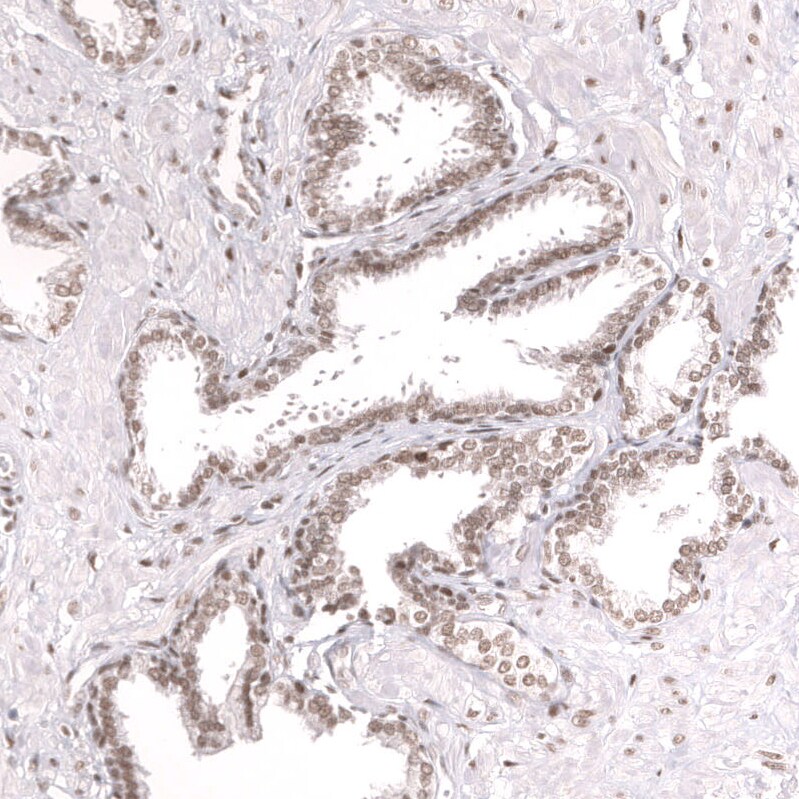 SNF5 Antibody (CL13992) - Azide and BSA Free Immunohistochemistry-Paraffin: SNF5 Antibody [NBP3-43862]