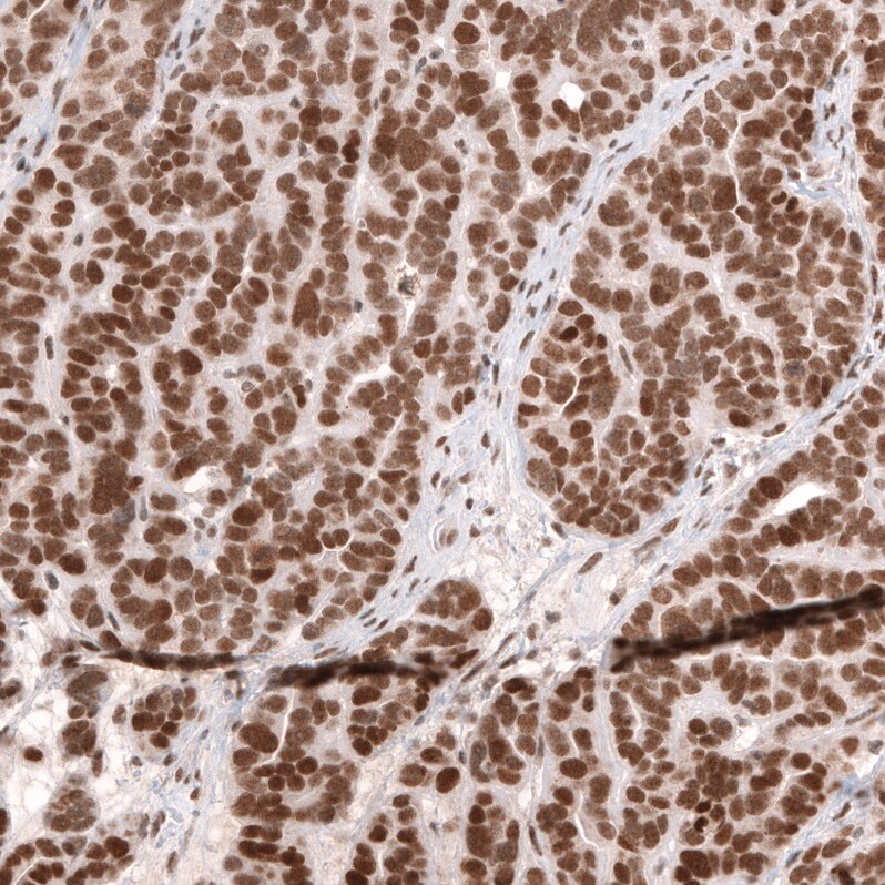 SNF5 Antibody (CL13992) - Azide and BSA Free Immunohistochemistry-Paraffin: SNF5 Antibody [NBP3-43862]