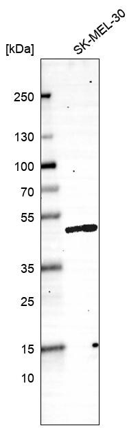 SNF5 Antibody (CL13992) - Azide and BSA Free Western Blot: SNF5 Antibody [NBP3-43862]