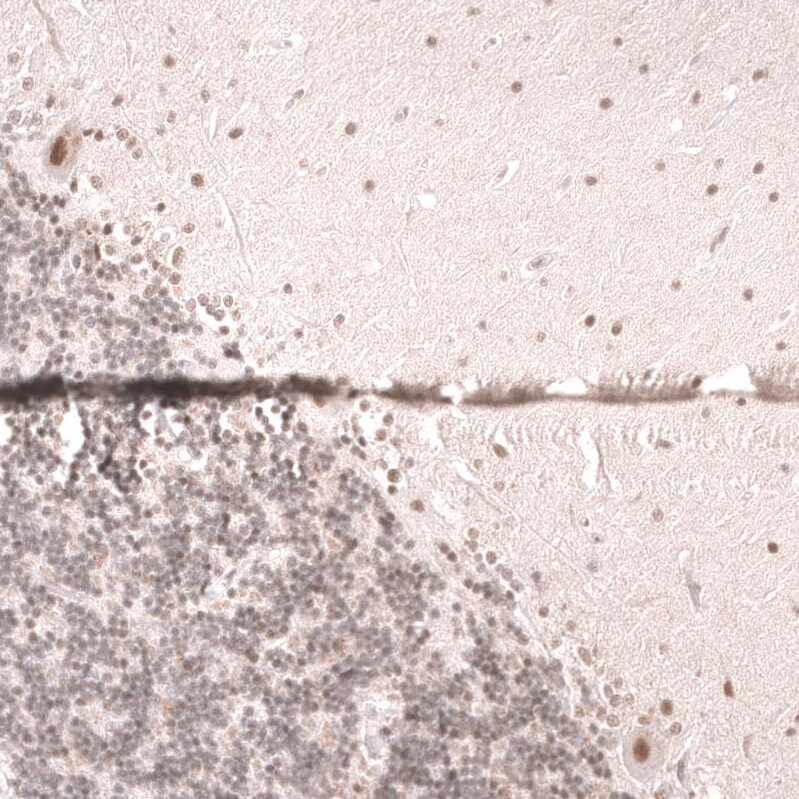 SNF5 Antibody (CL14017) - Azide and BSA Free Immunohistochemistry-Paraffin: SNF5 Antibody [NBP3-43863]