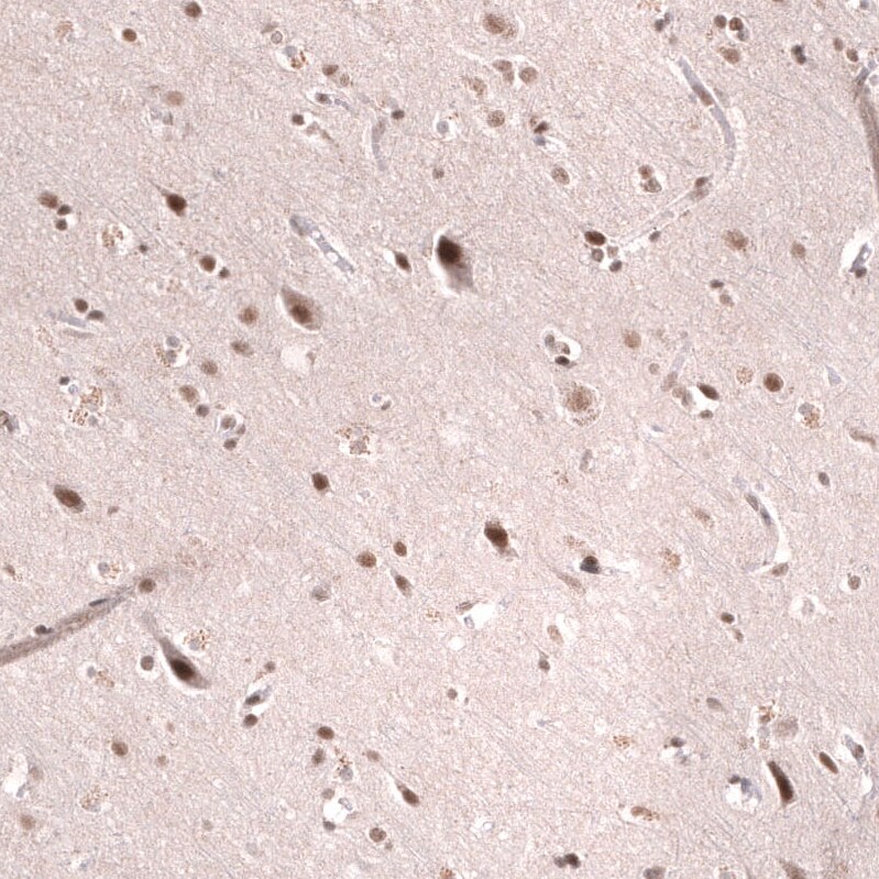 SNF5 Antibody (CL14017) - Azide and BSA Free Immunohistochemistry-Paraffin: SNF5 Antibody [NBP3-43863]