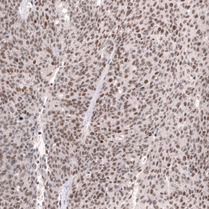 SNF5 Antibody (CL14017) - Azide and BSA Free Immunohistochemistry-Paraffin: SNF5 Antibody [NBP3-43863]