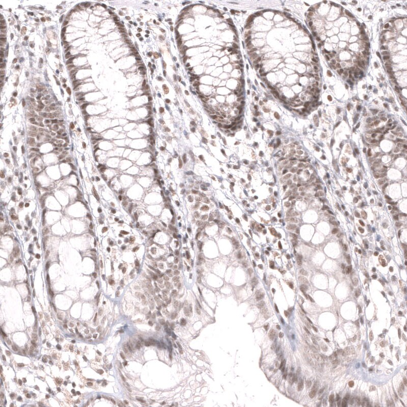 SNF5 Antibody (CL14017) - Azide and BSA Free Immunohistochemistry-Paraffin: SNF5 Antibody [NBP3-43863]