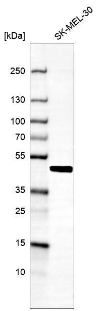 SNF5 Antibody (CL14017) - Azide and BSA Free Western Blot: SNF5 Antibody [NBP3-43863]