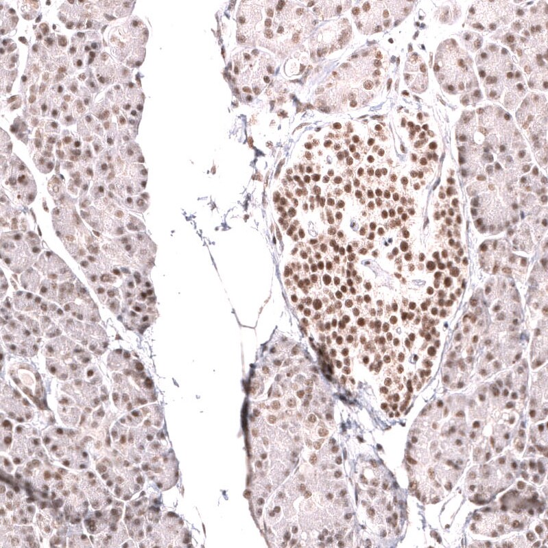 SNF5 Antibody (CL14017) - Azide and BSA Free Immunohistochemistry-Paraffin: SNF5 Antibody [NBP3-43863]