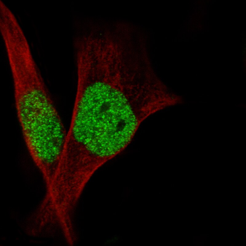 SNF5 Antibody (CL14031) - Azide and BSA Free Immunocytochemistry/ Immunofluorescence: SNF5 Antibody [NBP3-43864]