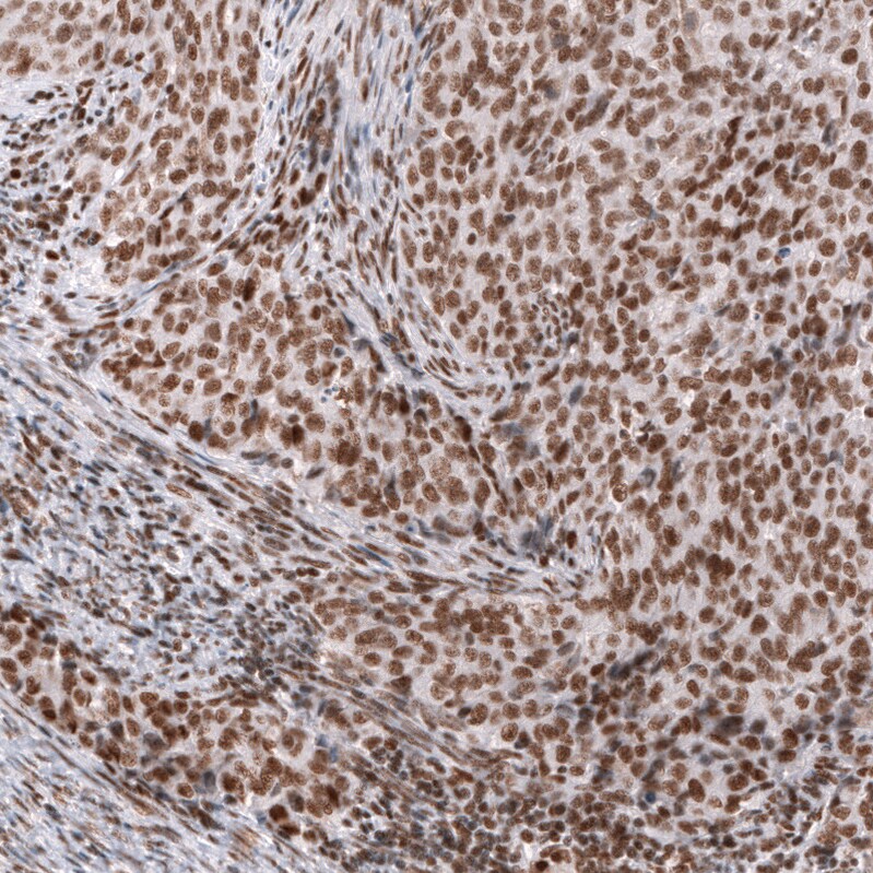 SNF5 Antibody (CL14031) - Azide and BSA Free Immunohistochemistry-Paraffin: SNF5 Antibody [NBP3-43864]