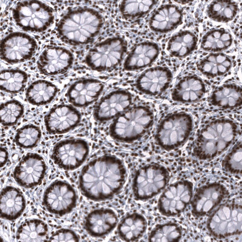 SNF5 Antibody (CL14031) - Azide and BSA Free Immunohistochemistry-Paraffin: SNF5 Antibody [NBP3-43864]