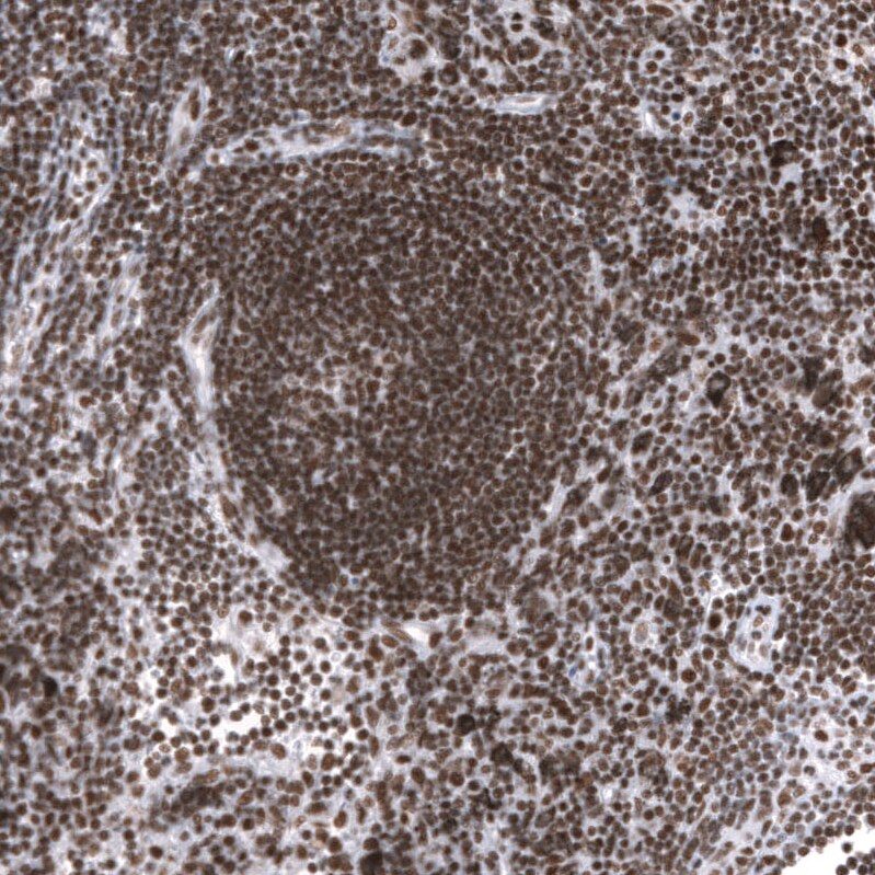 SNF5 Antibody (CL14031) - Azide and BSA Free Immunohistochemistry-Paraffin: SNF5 Antibody [NBP3-43864]
