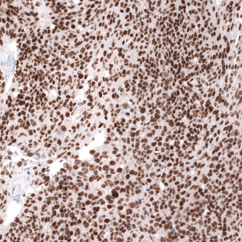 SNF5 Antibody (CL14031) - Azide and BSA Free Immunohistochemistry-Paraffin: SNF5 Antibody [NBP3-43864]