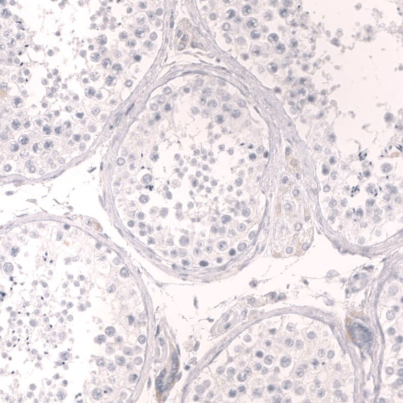 Troponin T Type 2 (cardiac) Antibody (CL13382) - Azide and BSA Free Immunohistochemistry-Paraffin: Troponin T Type 2 (cardiac) Antibody [NBP3-43865]