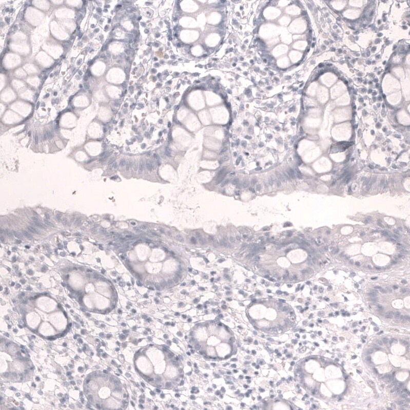 Troponin T Type 2 (cardiac) Antibody (CL13382) - Azide and BSA Free Immunohistochemistry-Paraffin: Troponin T Type 2 (cardiac) Antibody [NBP3-43865]