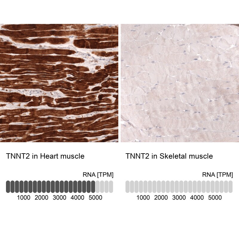 Troponin T Type 2 (cardiac) Antibody (CL13403) - Azide and BSA Free Immunohistochemistry-Paraffin: Troponin T Type 2 (cardiac) Antibody [NBP3-43866]