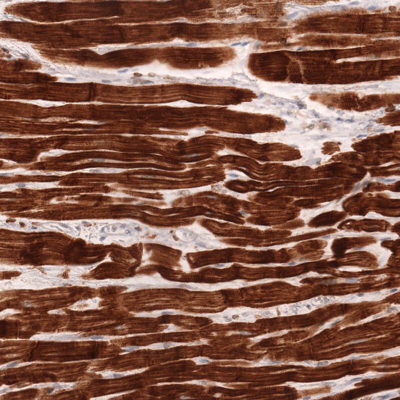 Troponin T Type 2 (cardiac) Antibody (CL13403) - Azide and BSA Free Immunohistochemistry-Paraffin: Troponin T Type 2 (cardiac) Antibody [NBP3-43866]