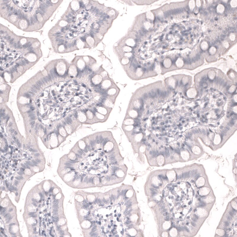 Troponin T Type 2 (cardiac) Antibody (CL13403) - Azide and BSA Free Immunohistochemistry-Paraffin: Troponin T Type 2 (cardiac) Antibody [NBP3-43866]