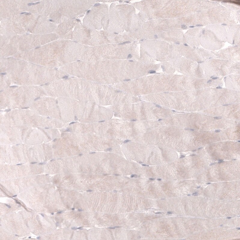Troponin T Type 2 (cardiac) Antibody (CL13403) - Azide and BSA Free Immunohistochemistry-Paraffin: Troponin T Type 2 (cardiac) Antibody [NBP3-43866]