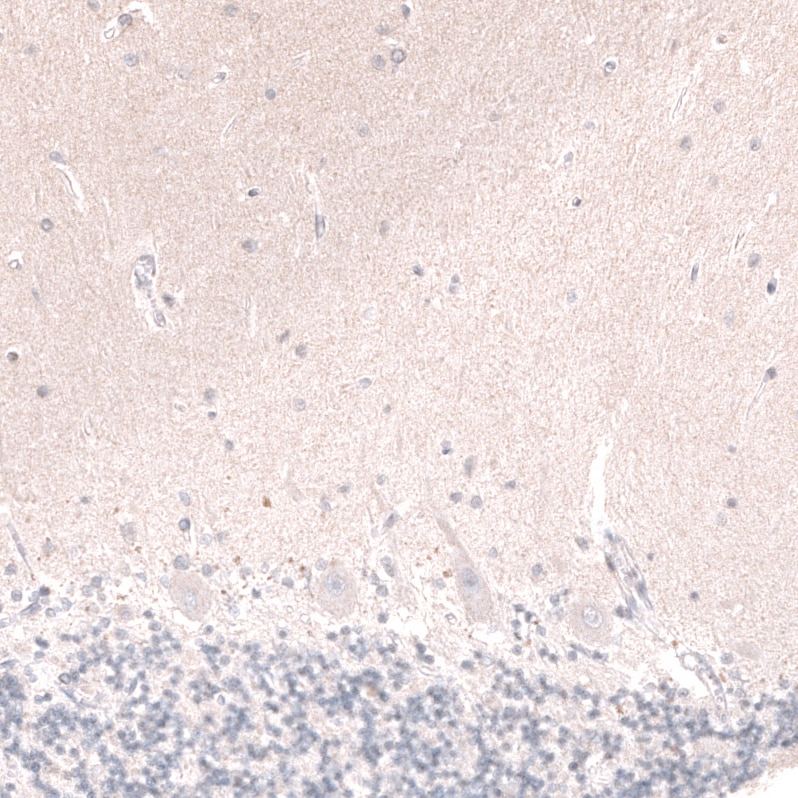 Wnt-5a Antibody (CL13683) - Azide and BSA Free Immunohistochemistry-Paraffin: Wnt-5a Antibody [NBP3-43867]