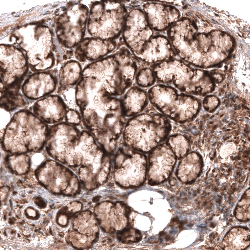 Wnt-5a Antibody (CL13683) - Azide and BSA Free Immunohistochemistry-Paraffin: Wnt-5a Antibody [NBP3-43867]