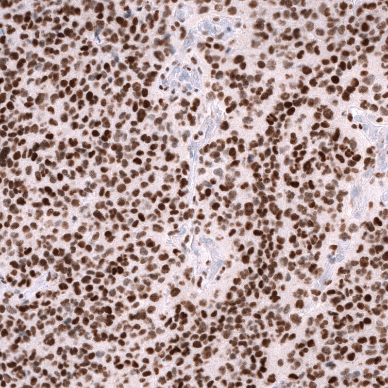 ZEB2 Antibody (CL13467) - Azide and BSA Free Immunohistochemistry-Paraffin: ZEB2 Antibody [NBP3-43869]