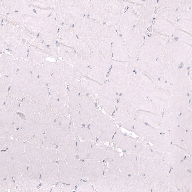 ZEB2 Antibody (CL13467) - Azide and BSA Free Immunohistochemistry-Paraffin: ZEB2 Antibody [NBP3-43869]