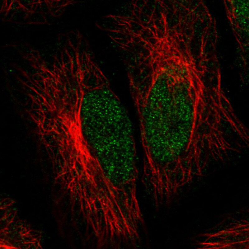 ATRX Antibody (CL0537) - Azide and BSA Free Immunocytochemistry/ Immunofluorescence: ATRX Antibody [NBP3-43870]