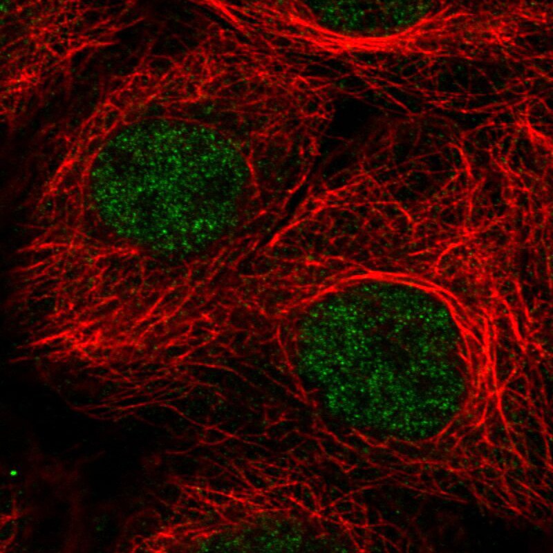 ATRX Antibody (CL0537) - Azide and BSA Free Immunocytochemistry/ Immunofluorescence: ATRX Antibody [NBP3-43870]