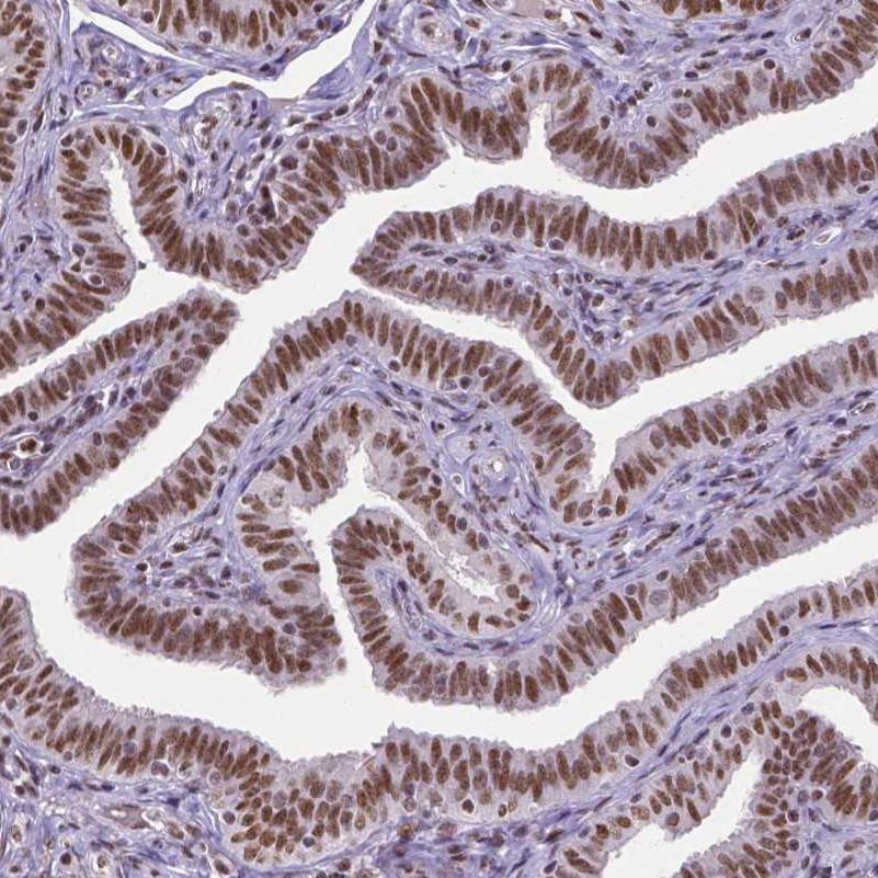 ATRX Antibody (CL0537) - Azide and BSA Free Immunohistochemistry-Paraffin: ATRX Antibody [NBP3-43870]