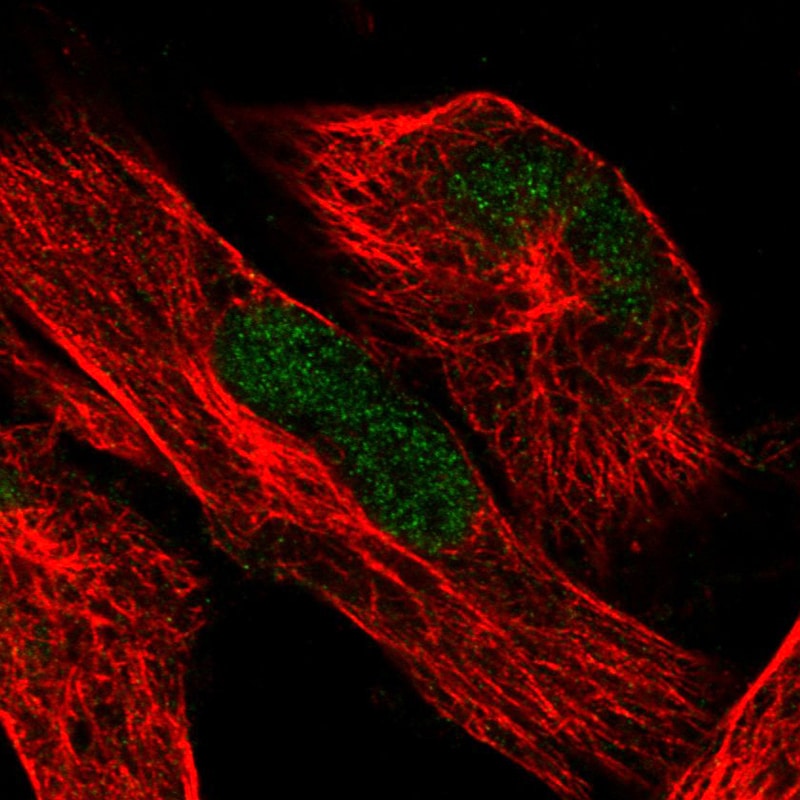 ATRX Antibody (CL0537) - Azide and BSA Free Immunocytochemistry/ Immunofluorescence: ATRX Antibody [NBP3-43870]