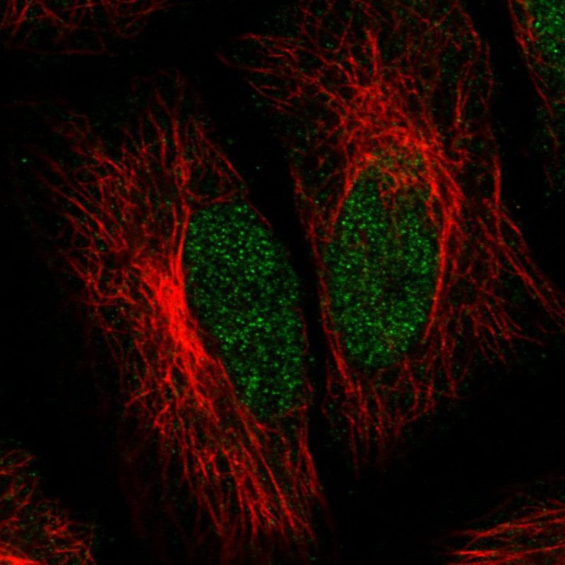 ATRX Antibody (CL0537) - Azide and BSA Free Immunocytochemistry/ Immunofluorescence: ATRX Antibody [NBP3-43870]