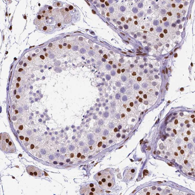ATRX Antibody (CL0537) - Azide and BSA Free Immunohistochemistry-Paraffin: ATRX Antibody [NBP3-43870]