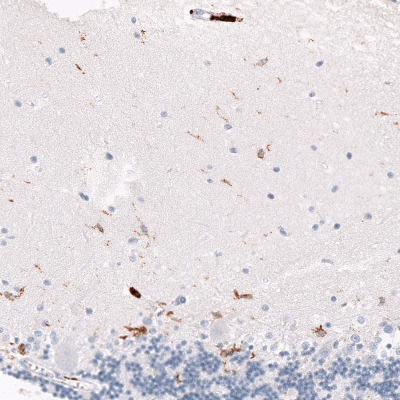 CD163 Antibody (CL10652) - Azide and BSA Free Immunohistochemistry-Paraffin: CD163 Antibody [NBP3-43871]