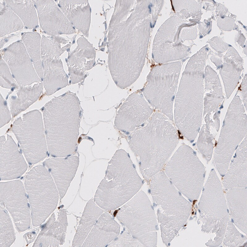 CD163 Antibody (CL10652) - Azide and BSA Free Immunohistochemistry-Paraffin: CD163 Antibody [NBP3-43871]