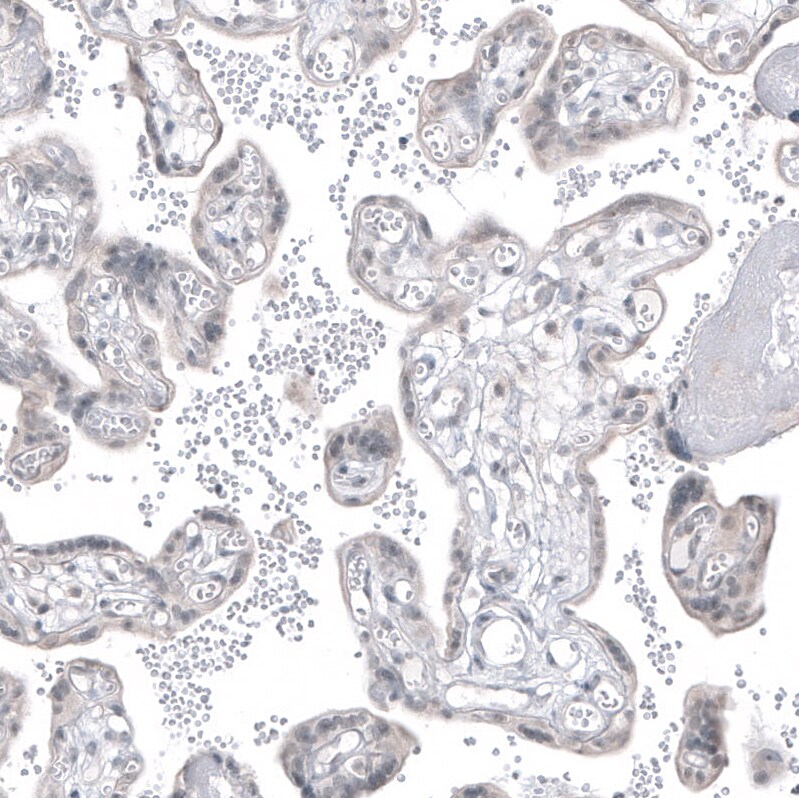 PSMA/FOLH1/NAALADase I Antibody (CL9089) - Azide and BSA Free Immunohistochemistry-Paraffin: PSMA/FOLH1/NAALADase I Antibody [NBP3-43872]