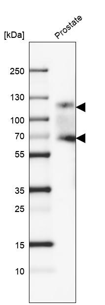 PSMA/FOLH1/NAALADase I Antibody (CL9091) - Azide and BSA Free Western Blot: PSMA/FOLH1/NAALADase I Antibody [NBP3-43873]