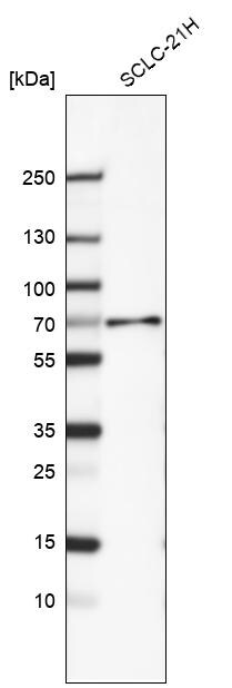 Smad4 Antibody (CL9774) - Azide and BSA Free Western Blot: Smad4 Antibody [NBP3-43874]