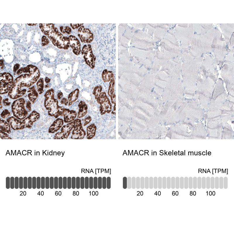 alpha-Methylacyl-CoA Racemase/AMACR Antibody (CL9360) - Azide and BSA Free Immunohistochemistry-Paraffin: alpha-Methylacyl-CoA Racemase/AMACR Antibody [NBP3-43875]