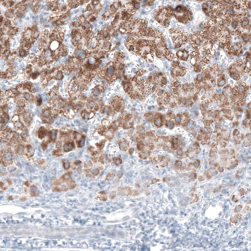 alpha-Methylacyl-CoA Racemase/AMACR Antibody (CL9360) - Azide and BSA Free Immunohistochemistry-Paraffin: alpha-Methylacyl-CoA Racemase/AMACR Antibody [NBP3-43875]