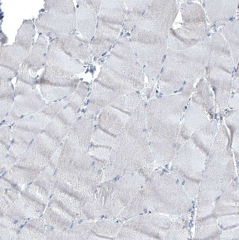alpha-Methylacyl-CoA Racemase/AMACR Antibody (CL9362) - Azide and BSA Free Immunohistochemistry-Paraffin: alpha-Methylacyl-CoA Racemase/AMACR Antibody [NBP3-43876]