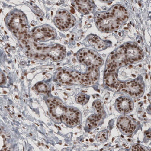 Daxx Antibody (CL3580) - Azide and BSA Free Immunohistochemistry-Paraffin: Daxx Antibody [NBP3-43879]