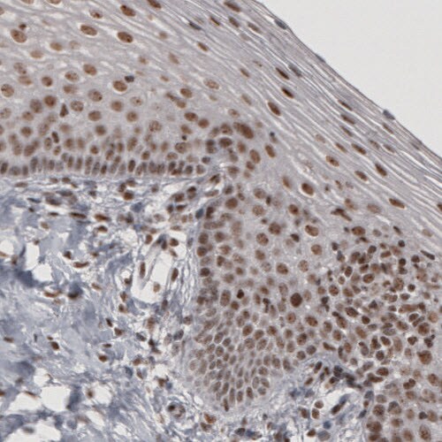 Daxx Antibody (CL3580) - Azide and BSA Free Immunohistochemistry-Paraffin: Daxx Antibody [NBP3-43879]