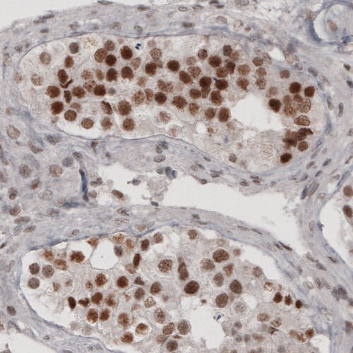 Daxx Antibody (CL3580) - Azide and BSA Free Immunohistochemistry-Paraffin: Daxx Antibody [NBP3-43879]