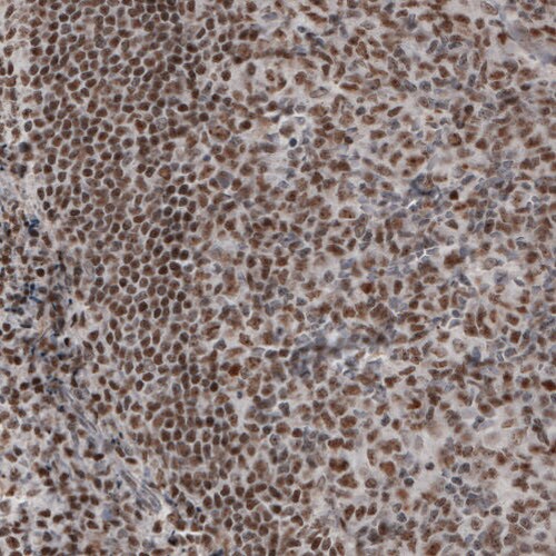 Daxx Antibody (CL3580) - Azide and BSA Free Immunohistochemistry-Paraffin: Daxx Antibody [NBP3-43879]