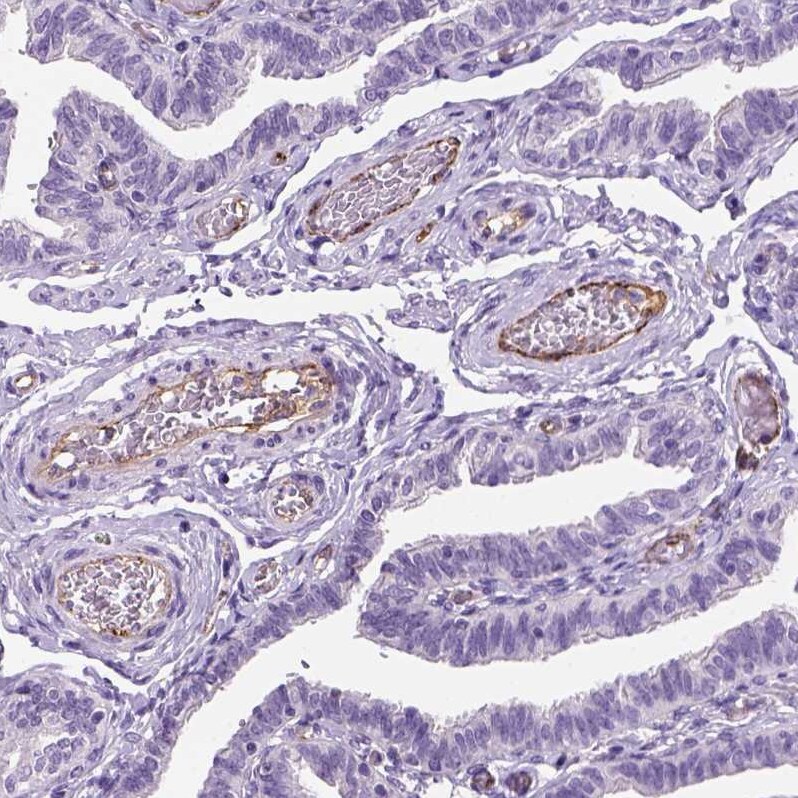 Von Willebrand Factor Antibody (CL1950) - Azide and BSA Free Immunohistochemistry-Paraffin: Von Willebrand Factor Antibody [NBP3-43880]