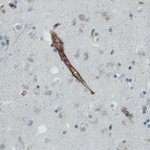 Endoglin/CD105 Antibody (CL1912) - Azide and BSA Free Immunohistochemistry-Paraffin: Endoglin/CD105 Antibody [NBP3-43882]