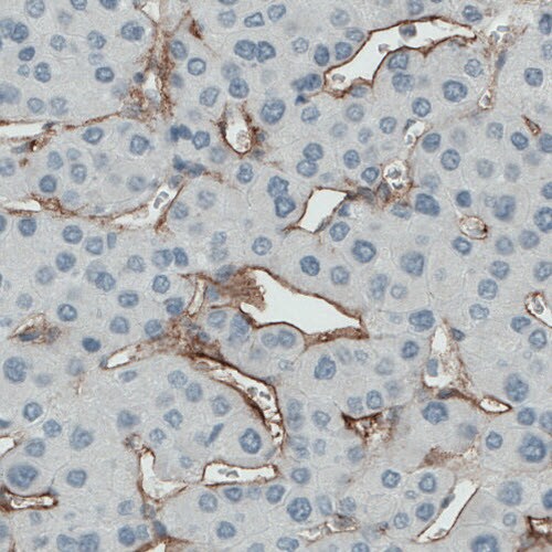 Endoglin/CD105 Antibody (CL1912) - Azide and BSA Free Immunohistochemistry-Paraffin: Endoglin/CD105 Antibody [NBP3-43882]