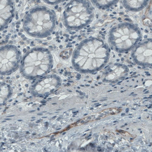 Endoglin/CD105 Antibody (CL1912) - Azide and BSA Free Immunohistochemistry-Paraffin: Endoglin/CD105 Antibody [NBP3-43882]