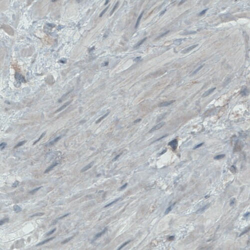 Endoglin/CD105 Antibody (CL1912) - Azide and BSA Free Immunohistochemistry-Paraffin: Endoglin/CD105 Antibody [NBP3-43882]