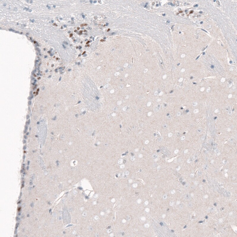 POU3F2/OCT7 Antibody (CL6228) - Azide and BSA Free Immunohistochemistry-Paraffin: POU3F2/OCT7 Antibody [NBP3-43883]