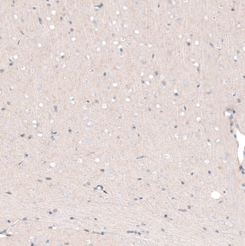 POU3F2/OCT7 Antibody (CL6228) - Azide and BSA Free Immunohistochemistry-Paraffin: POU3F2/OCT7 Antibody [NBP3-43883]